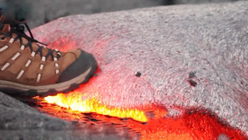 “开云电竞”郑州痔疮专业的治疗方法有哪些(图1) 开云电竞