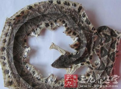 缓解类风湿引发头痛有小妙招‘开云电竞’(图2) 开云电竞官网